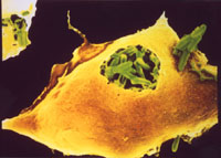 Picture of Mycobacteria